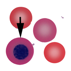 NRBC1A.png