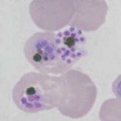 Mature schizonts note the clumped brown pigment surrounded by loosely arranged merooites
