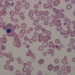 Agglutination2.jpg