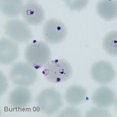 Two early forms of P.falciparum one with the characteristic double chromatin dot
