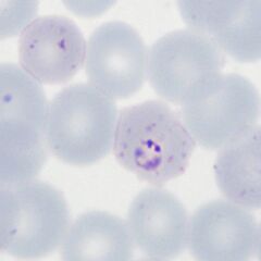Double chromatin dot form also Maurers dost and clefts, slight crenation and lost pallor