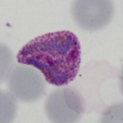Developing late trophozoite The ring form is lost, the parasite is very irregular