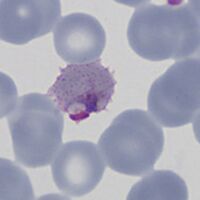faint Ziemann's dots