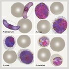 Identifying maaria species (thin films)