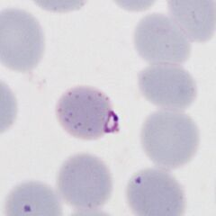 Multiple parasites Two parasites within a single red cells (arrowed)