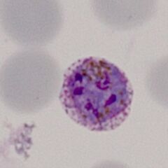 Developing late trophozoite The ring form is lost, the parasite is very irregular