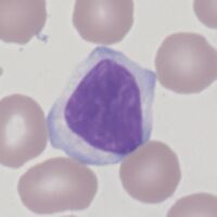 CLL.jpg