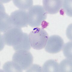 Accolé form: The arrowed form is closely associated with the red cell membrane