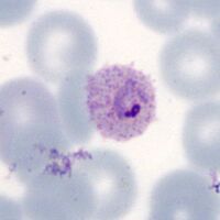 Ring with dots/fimbriation