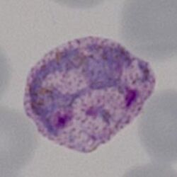 Amoeboid2.jpg