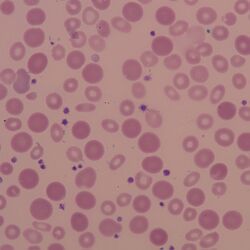 Anisochromia 2.jpg