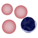 Microcytic and Hypochromic Red Cells