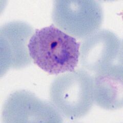 Intermediate ring The ring is large and the red cell shows some ovoid features of shape