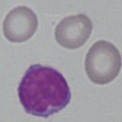 HypoC2.jpg