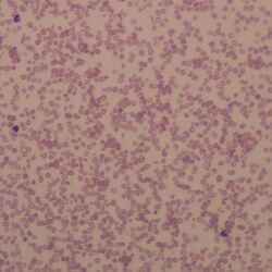 Agglutination1.jpg
