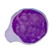 Lymphoblast.png