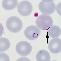 Accolé form: The arrowed form is closely associated with the red cell membrane