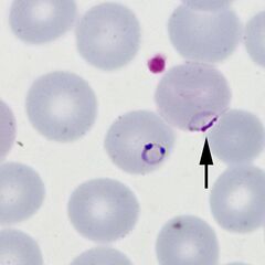 Accolé form: The arrowed form is closely associated with the red cell membrane
