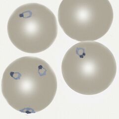 Delicate and small early trophozoite forms