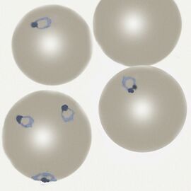 Early trophozoite forms showing the typical delicate ring forms of early trophozoites occupying less than 25% of the red cell widthh.