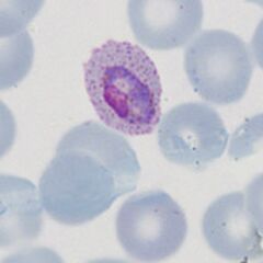 Early ring form Dots are now more visible and the red cell begins to show fimbriation.