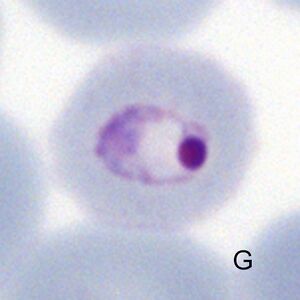 Mature schizont releasing merozoites
