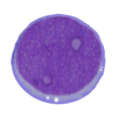AML M1.png