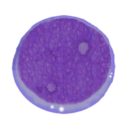 AML M1.png
