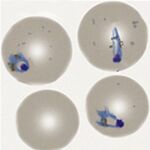 Late trophozoite