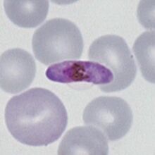 : P.falciparum macrogametocyte