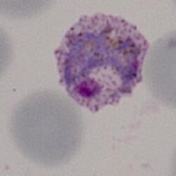 Amoeboid1.jpg