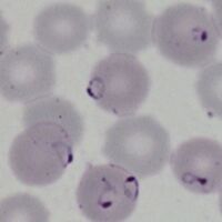 PFET-main image.jpg