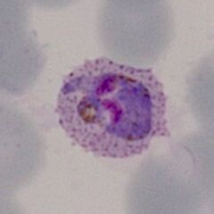 Late trophozoite Similar to the previous example, the ring structure is entirely lost