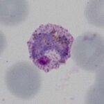 Intermediate large thickened trophozoite