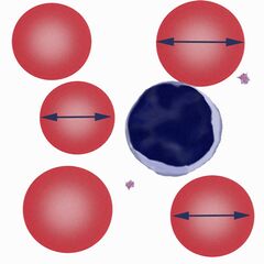 RC C anisocytosis G.jpg