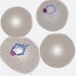 Early trophozoite
