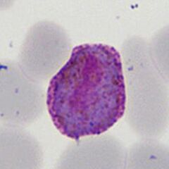 Developing late trophozoite The ring form is lost, the parasite is very irregular