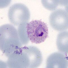 Early ring form Dots are now more visible and the red cell begins to show fimbriation.