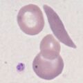 Thumbnail for version as of 17:18, 11 March 2023
