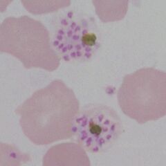 Accolé form: closely associated with the red cell membrane, scanty mauers dots