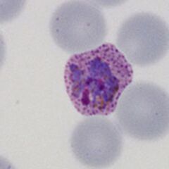 Late trophozoite Note the solid parasite and the red cell begins to show distortion.