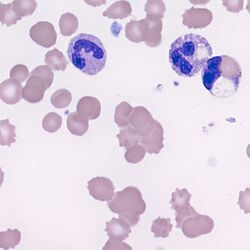 Agglutination3.jpg