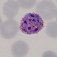 Late trophozoite Note the solid parasite and the red cell begins to show distortion.
